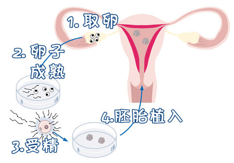 关于{ k1=g1 }